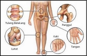 sakit tulang badan